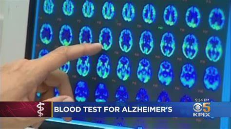 The breakthrough blood test for Alzheimers