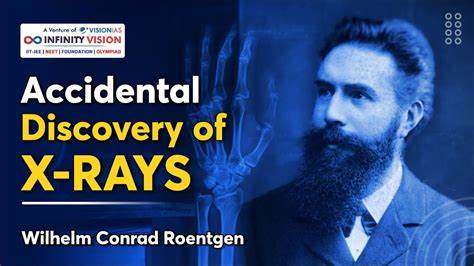 The Accidental Discovery of X-Rays and Its Impact on Medical Science