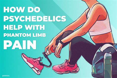 Psychedelics can help with phantom limb pain
