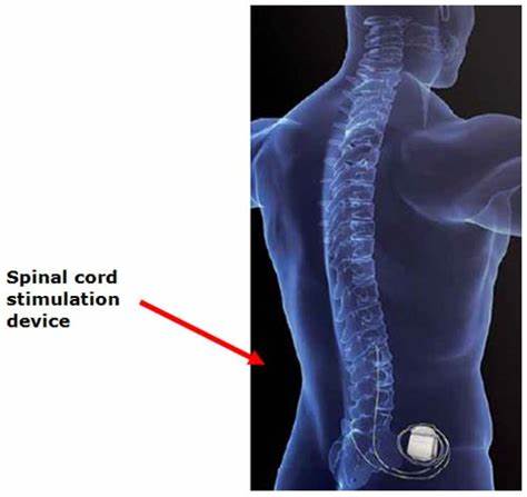 Brain decoder controls spinal cord stimulation