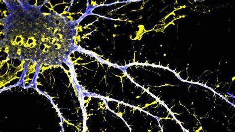 New analogue of LSD shows potential as non-dopaminergic antipsychotic(in mice)