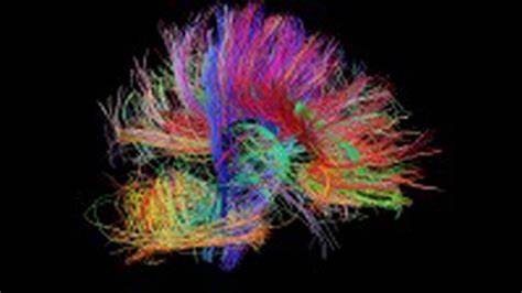 Brain scans reveal neural circuitry linked with the interpretation of art