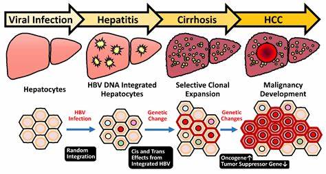 The role of the hepatitis B virus genome and its integration in the hepatocellular carcinoma